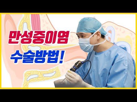 만성중이염 내시경중이염 수술방법 치료방법