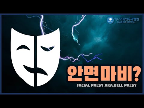 특발성 안면마비(벨 마비)란 무엇인가요?