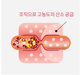 고압산소치료 중인 혈관 모식도 — 좁아진 혈관 너머 조직으로 고농도 산소가 공급되는 모습