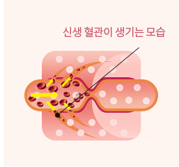 신생혈관 형성과 손상 조직 회복 모식도 — 신생 혈관이 생기는 모습