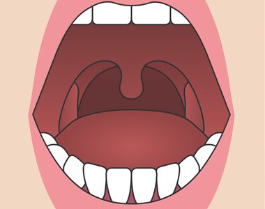 성인 정상 편도 사진
